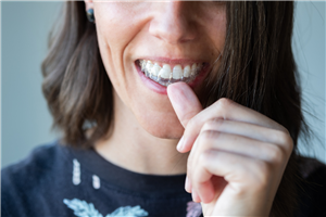 Invisalign Warminster 